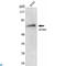 Acyl-CoA Synthetase Medium Chain Family Member 3 antibody, LS-C812871, Lifespan Biosciences, Western Blot image 