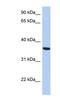 Phosphoseryl-TRNA Kinase antibody, NBP1-70690, Novus Biologicals, Western Blot image 