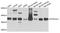 Dynein Cytoplasmic 2 Light Intermediate Chain 1 antibody, PA5-76175, Invitrogen Antibodies, Western Blot image 