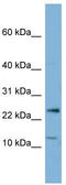 Protein Phosphatase 1 Regulatory Inhibitor Subunit 11 antibody, TA346638, Origene, Western Blot image 