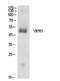 Vasoactive Intestinal Peptide Receptor 1 antibody, STJ97269, St John