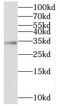 Insulin Like Growth Factor Binding Protein 2 antibody, FNab10211, FineTest, Western Blot image 