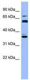 Cytochrome P450 Family 2 Subfamily B Member 6 antibody, TA346223, Origene, Western Blot image 