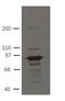 Plakophilin 3 antibody, MA5-18080, Invitrogen Antibodies, Western Blot image 