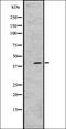 Lysophosphatidic Acid Receptor 1 antibody, orb335596, Biorbyt, Western Blot image 