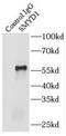 SET And MYND Domain Containing 1 antibody, FNab08047, FineTest, Immunoprecipitation image 