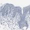 Filamin C antibody, HPA006135, Atlas Antibodies, Immunohistochemistry frozen image 
