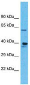 Olfactory Receptor Family 4 Subfamily K Member 1 antibody, TA337508, Origene, Western Blot image 