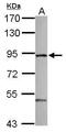 Zinc Finger FYVE-Type Containing 1 antibody, GTX116203, GeneTex, Western Blot image 
