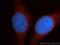 Renin antibody, 14291-1-AP, Proteintech Group, Immunofluorescence image 