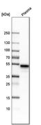Leucine Rich Alpha-2-Glycoprotein 1 antibody, HPA001888, Atlas Antibodies, Western Blot image 