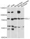 Delta Like Canonical Notch Ligand 1 antibody, LS-C749279, Lifespan Biosciences, Western Blot image 