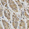 Hepatic lipase antibody, LS-C331464, Lifespan Biosciences, Immunohistochemistry paraffin image 
