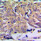 Peroxisomal membrane protein 2 antibody, LS-C358263, Lifespan Biosciences, Immunohistochemistry frozen image 