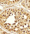 Proteasome Subunit Alpha 5 antibody, M07499, Boster Biological Technology, Immunohistochemistry paraffin image 
