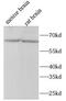 Forkhead box protein O6 antibody, FNab10457, FineTest, Western Blot image 