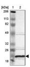 ALG13 UDP-N-Acetylglucosaminyltransferase Subunit antibody, NBP1-84330, Novus Biologicals, Western Blot image 