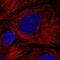 HPS4 Biogenesis Of Lysosomal Organelles Complex 3 Subunit 2 antibody, NBP2-31898, Novus Biologicals, Immunocytochemistry image 
