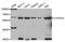 Cytochrome P450 Family 2 Subfamily C Member 9 antibody, A6219, ABclonal Technology, Western Blot image 