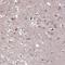 Calpain 12 antibody, NBP2-49079, Novus Biologicals, Immunohistochemistry frozen image 