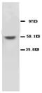 Matrix Metallopeptidase 16 antibody, AP23329PU-N, Origene, Western Blot image 