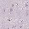 Dynein Axonemal Heavy Chain 12 antibody, NBP2-38845, Novus Biologicals, Immunohistochemistry paraffin image 