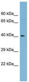 Leucine Rich Repeat Containing 71 antibody, TA340355, Origene, Western Blot image 