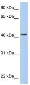 AT-Rich Interaction Domain 3C antibody, TA339645, Origene, Western Blot image 