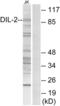 TPX2 Microtubule Nucleation Factor antibody, abx013850, Abbexa, Western Blot image 