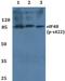 Eukaryotic translation initiation factor 4B antibody, A00846S422-1, Boster Biological Technology, Western Blot image 