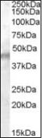 Potassium Voltage-Gated Channel Subfamily J Member 11 antibody, orb88780, Biorbyt, Western Blot image 
