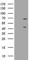 Methyltransferase-like protein 16 antibody, CF504697, Origene, Western Blot image 