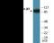 Integrin Subunit Beta 3 antibody, EKC2436, Boster Biological Technology, Western Blot image 