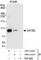 DNA-binding protein SATB2 antibody, NBP1-03327, Novus Biologicals, Immunoprecipitation image 