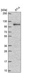 ARVCF Delta Catenin Family Member antibody, PA5-64129, Invitrogen Antibodies, Western Blot image 