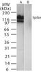 SARS Spike glycoprotein antibody, PA1-41385, Invitrogen Antibodies, Western Blot image 