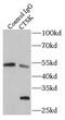 Cathepsin K antibody, FNab01310, FineTest, Immunoprecipitation image 