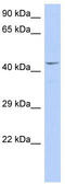 TATA-Box Binding Protein Associated Factor 7 antibody, TA330162, Origene, Western Blot image 