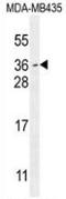 Myc target protein 1 antibody, AP52787PU-N, Origene, Western Blot image 