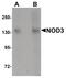 NLR Family CARD Domain Containing 3 antibody, PA5-21016, Invitrogen Antibodies, Western Blot image 