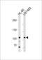MORC family CW-type zinc finger protein 3 antibody, LS-B13779, Lifespan Biosciences, Western Blot image 
