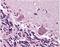 Cerebellar Degeneration Related Protein 2 antibody, PA1-46001, Invitrogen Antibodies, Immunohistochemistry paraffin image 