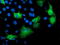Katanin p80 WD40-containing subunit B1 antibody, M08144, Boster Biological Technology, Immunofluorescence image 