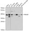 Protein Kinase AMP-Activated Non-Catalytic Subunit Beta 1 antibody, 13-300, ProSci, Western Blot image 