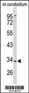 Peroxisome biogenesis factor 2 antibody, 63-823, ProSci, Western Blot image 