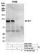 Sp1 Transcription Factor antibody, A303-944A, Bethyl Labs, Immunoprecipitation image 