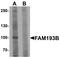 Family With Sequence Similarity 193 Member B antibody, A14525, Boster Biological Technology, Western Blot image 