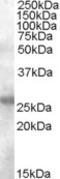 Activation-induced cytidine deaminase antibody, TA303351, Origene, Western Blot image 