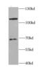 Cbl Proto-Oncogene B antibody, FNab01318, FineTest, Western Blot image 
