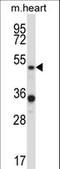 Protein Inhibitor Of Activated STAT 4 antibody, LS-C163710, Lifespan Biosciences, Western Blot image 